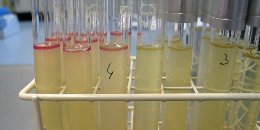Mikrobiologische Untersuchung Mikrobiologische Untersuchung