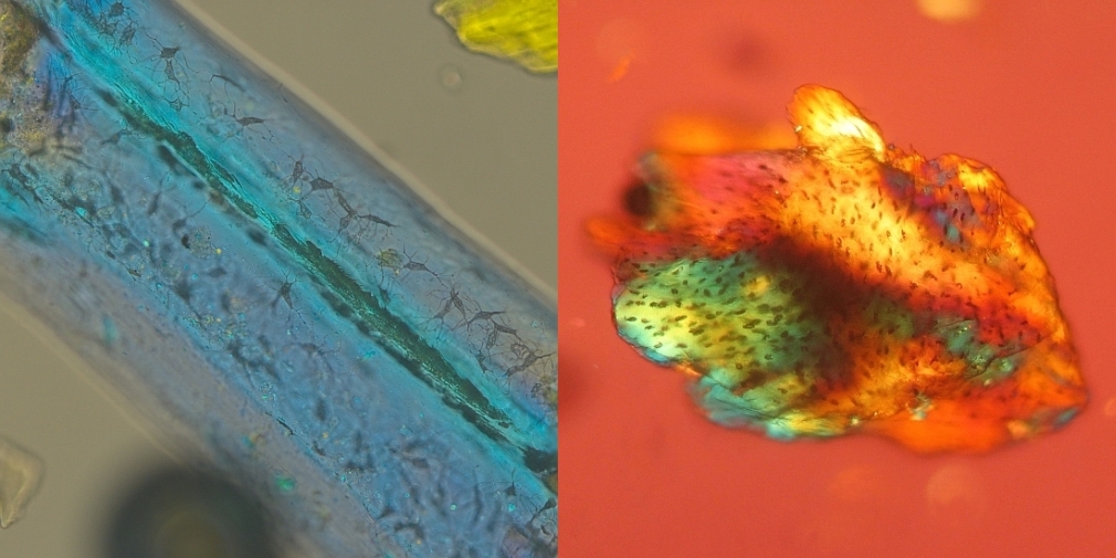 Tierische Bestandteile im polarisierten Licht